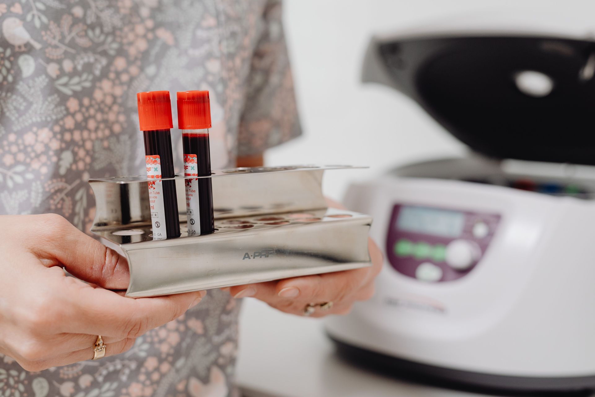 Close-up of blood vials in a laboratory setting, ready for testing.